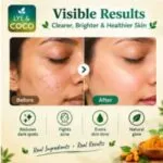 Turmeric Soap (3- Pack) 100g - image 2