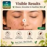 Vetiver Soap (3- pack) 100g - image 2
