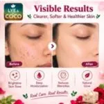 Rose petal soap (3- pack) 100g - image 2